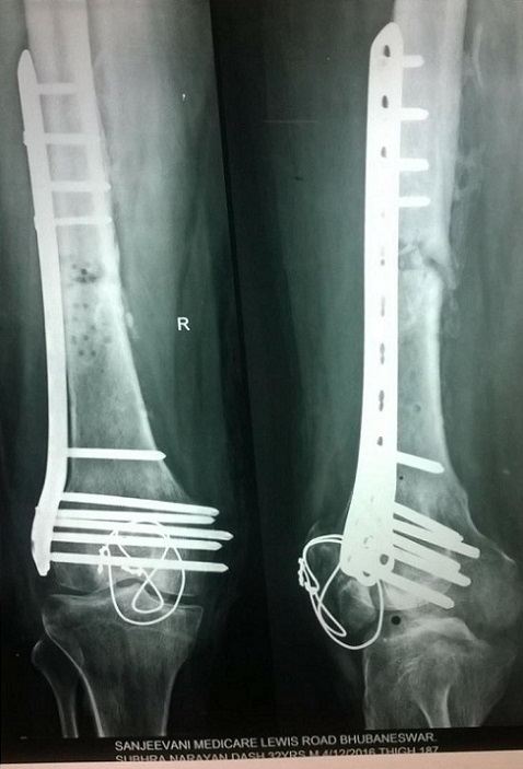 Condition After 2 Years