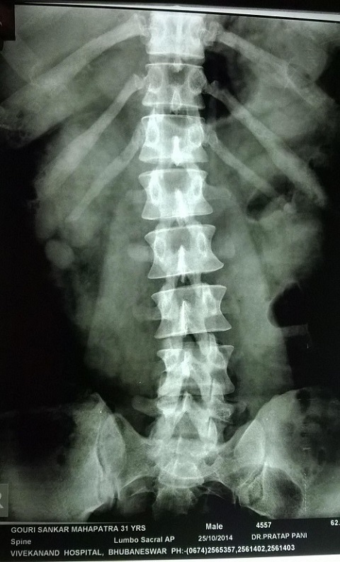 X-Ray Gouri Shankar Mohapatra